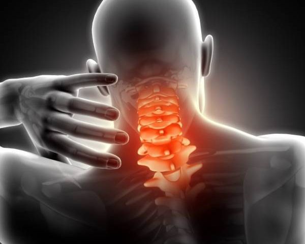 بیرون زدگی دیسک گردن