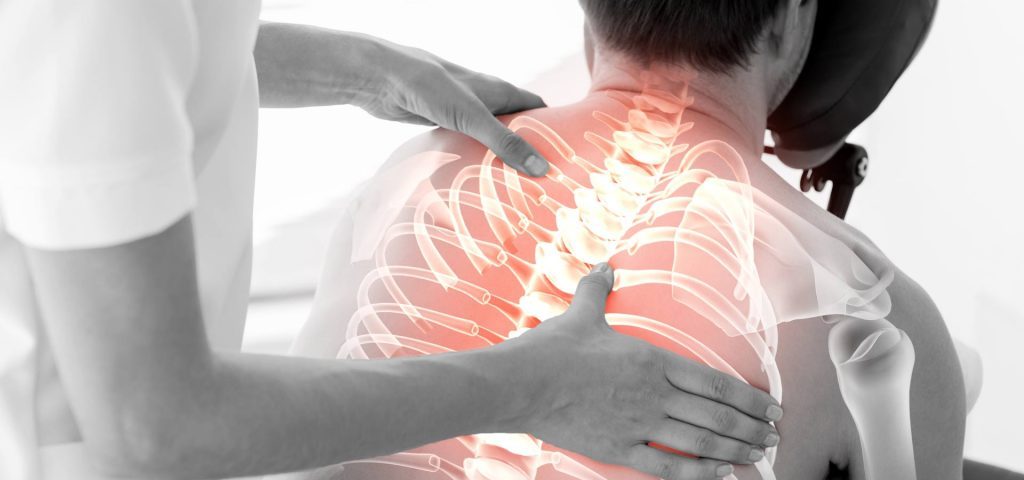 اسپوندیلیت آنکیلوزان