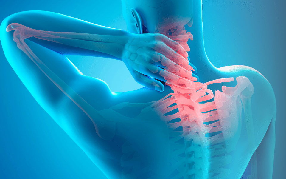 فیزیوتراپی فتق دیسک گردن