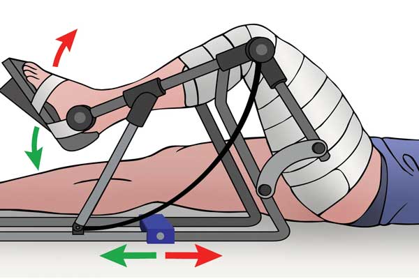 دستگاه CPM فیزیوتراپی