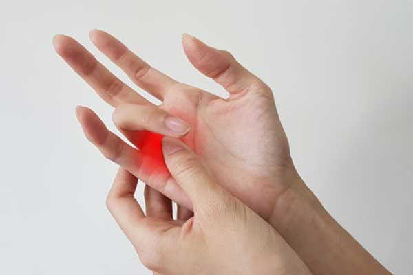 فیزیوتراپی انگشت ماشه‌ ای